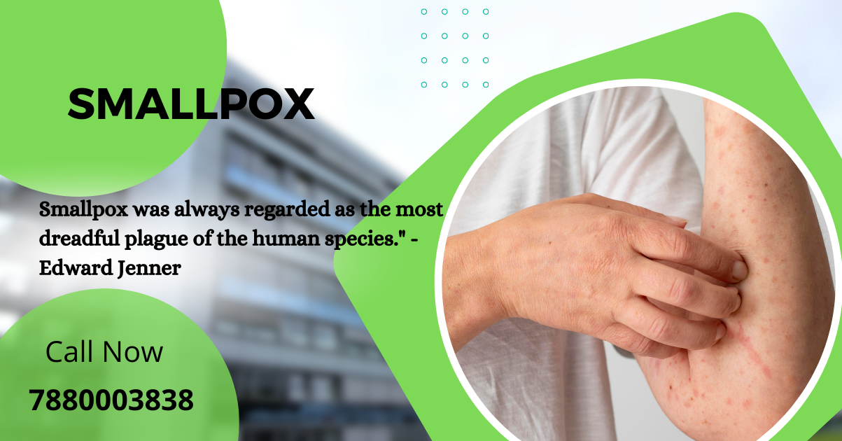 Be Safe from Smallpox: Know the Symptoms, Causes, and Prevention