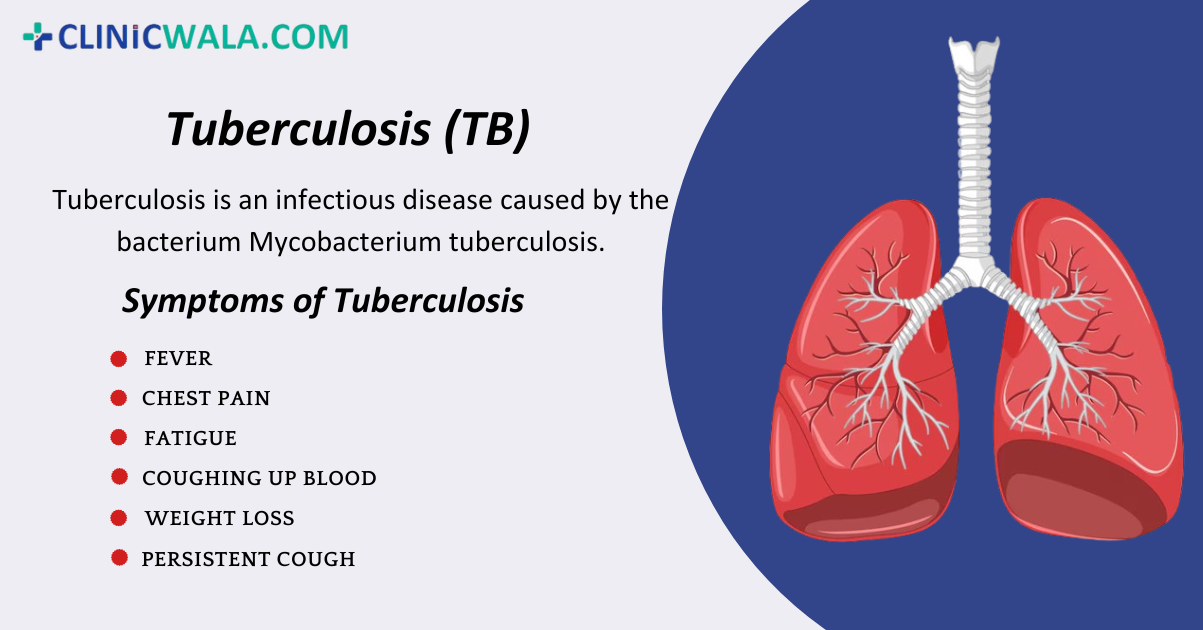 Tuberculosis (TB): Symptoms, Causes and Treatment