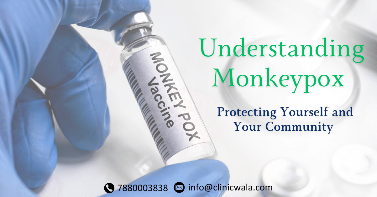 Monkeypox: Symptoms, Prevention, and WHO's Response - Know the Current Status of This Viral Disease