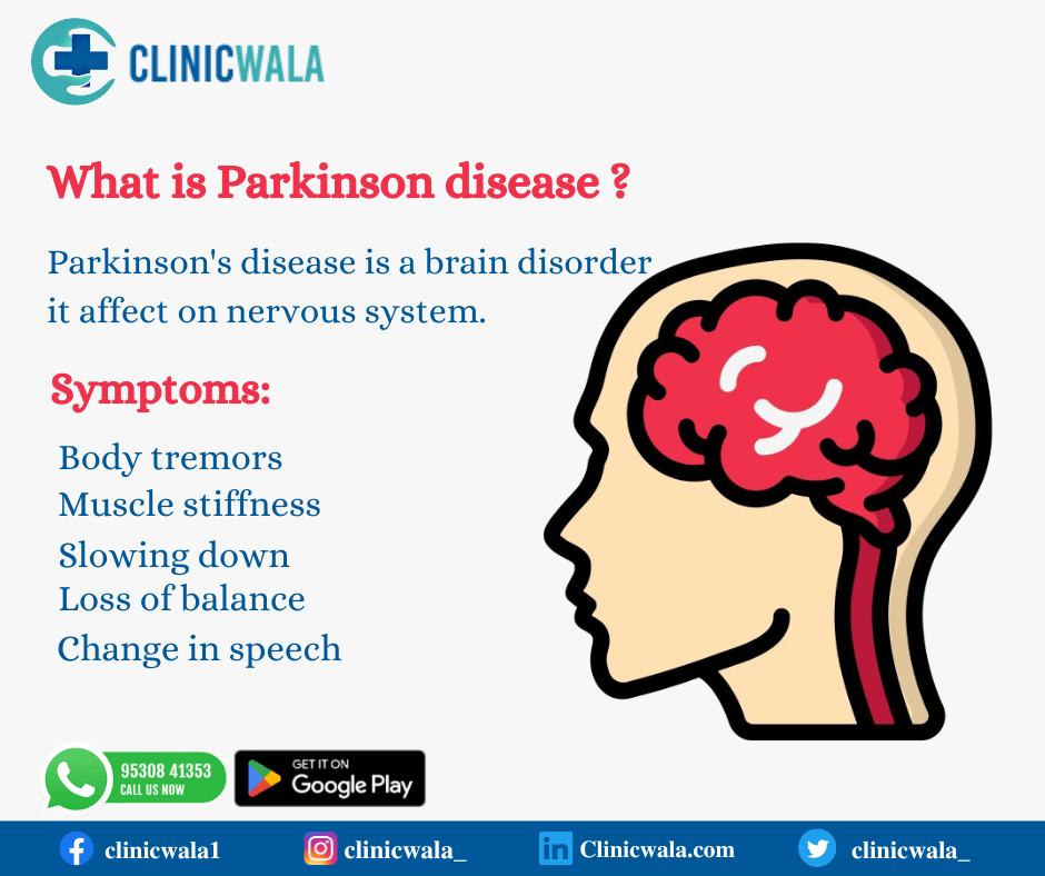 पार्किंसंस रोग प्रबंधन